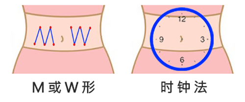 丹纳胰岛素泵