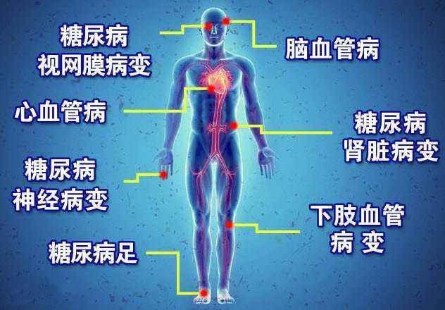 常见<a href='http://www.dana11.com/ktzs/tnbbfz/' target='_blank'><u>糖尿病并发症</u></a>有哪些