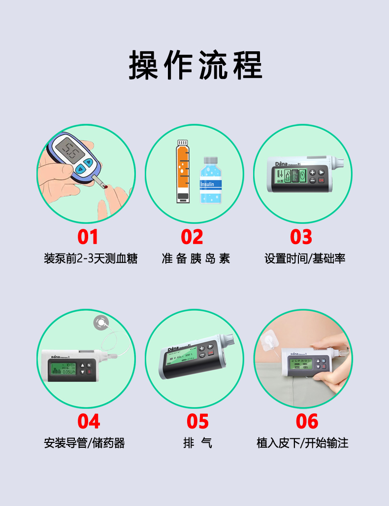 丹纳RE型<a href='http://www.dana11.com/ktzs/ydsbbd/96.html' target='_blank'><u>胰岛素泵安装</u></a>操作流程