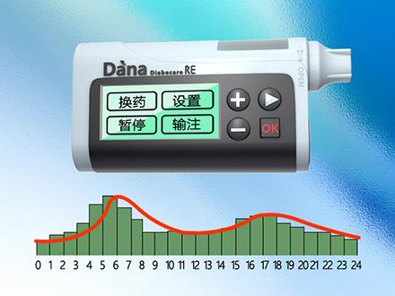 操作简单的丹纳RE型胰岛素泵